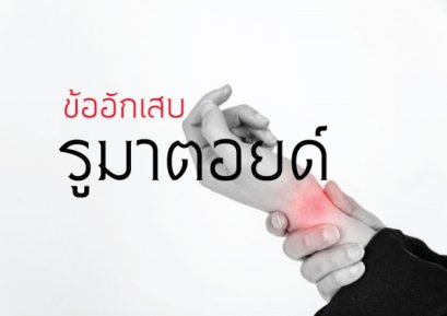 ข้ออักเสบรูมาตอยด์ : Rheumatoid Arthritis 