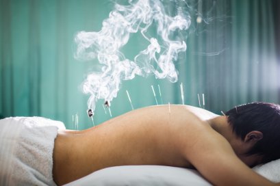 การรมยาด้วยศาสตร์การแพทย์แผนจีน