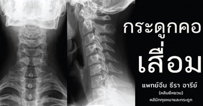 โรคกระดูกคอเสื่อม Cervical Spondylosis