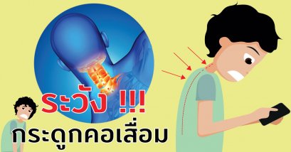 พฤติกรรมที่อาจทำให้กระดูกคอเสื่อม