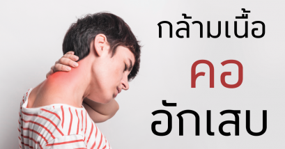 กล้ามเนื้อคออักเสบ (Neck sprain)