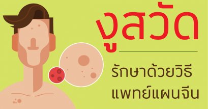 งูสวัด Varicella zoster virus โรคผิวหนังที่หลบซุกซ่อนรอวันปะทุ