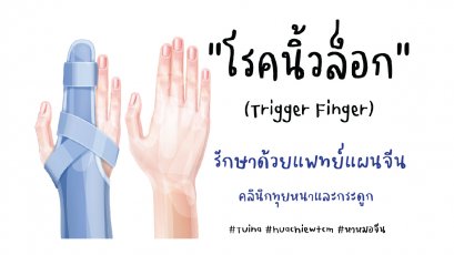 โรคนิ้วล็อก Trigger Finger