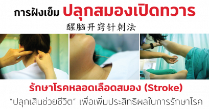 การฝังเข็มปลุกสมองเปิดทวาร