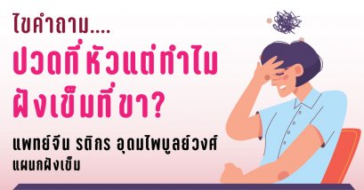ไขคำถาม....ปวดที่หัวแต่ทำไมฝังเข็มที่ขา?