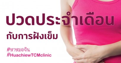 ฝังเข็มรักษาอาการปวดประจำเดือน