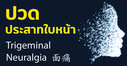 ปวดประสาทใบหน้า Trigeminal Neuralgia  面痛