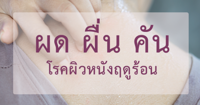 ผดผื่นในฤดูร้อน โรคผิวหนังที่มาพร้อมอากาศเปลี่ยนแปลง