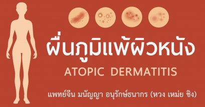 ผื่นภูมิแพ้ผิวหนัง โรคผิวหนังที่พบได้บ่อยในทุกเพศทุกวัย