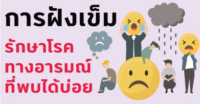 ฝังเข็มรักษาโรคทางอารมณ์ที่พบได้บ่อย
