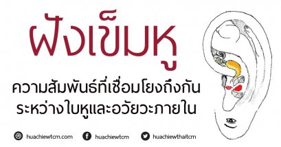 การฝังเข็มหู  Ear Acupuncture Therapy