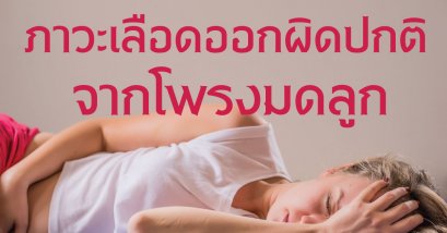 ภาวะเลือดออกผิดปกติจากโพรงมดลูก