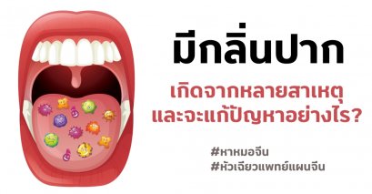 ภาวะการมีกลิ่นปาก