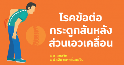 โรคข้อต่อกระดูกสันหลังส่วนเอวเคลื่อน