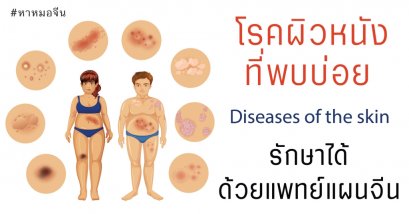 โรคผิวหนังที่พบบ่อย รักษาได้ด้วยวิธีแพทย์แผนจีน