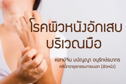 โรคผิวหนังอักเสบบริเวณมือ 手部湿疹 Eczema