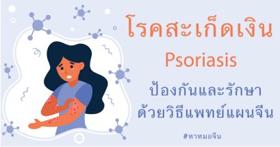 รู้จักโรคสะเก็ดเงิน (Psoriasis) ป้องกันและรักษาด้วยวิธีแพทย์แผนจีน