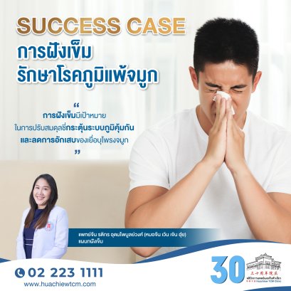 Success case การฝังเข็มรักษาโรคภูมิแพ้จมูก 