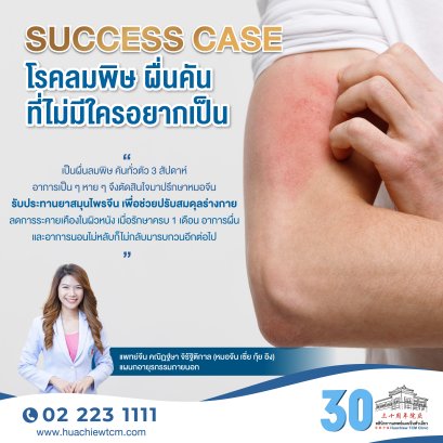 Success case โรคลมพิษ ผื่นคันที่ไม่มีใครอยากเป็น
