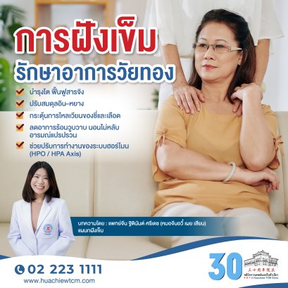 การฝังเข็มรักษาอาการวัยทอง