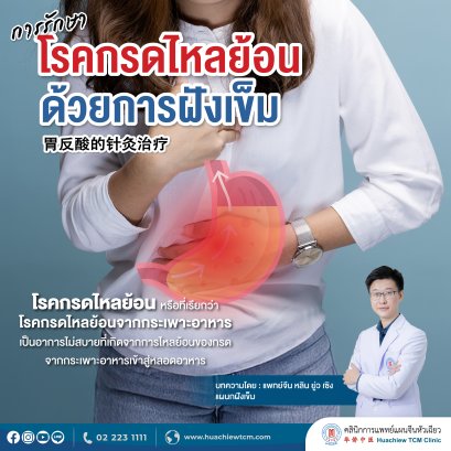 การรักษาโรคกรดไหลย้อนด้วยการฝังเข็ม