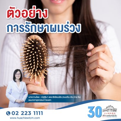 ตัวอย่างการรักษาผมร่วง