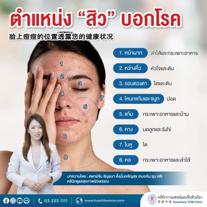 ตำแหน่ง สิวบอกโรค