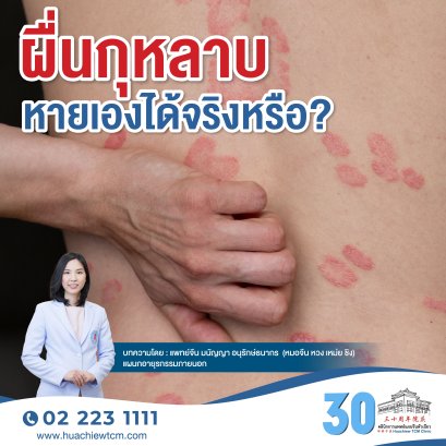 ผื่นกุหลาบหายเองได้จริงหรือ?