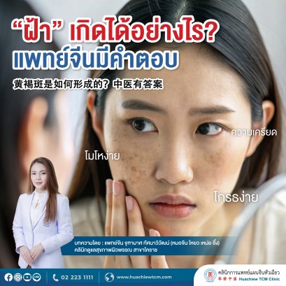  ฝ้า เกิดได้อย่างไร? แพทย์จีนมีคำตอบ