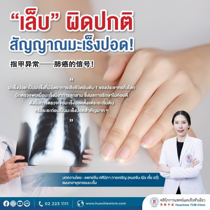 เล็บ ผิดปกติ สัญญาณมะเร็งปอด！