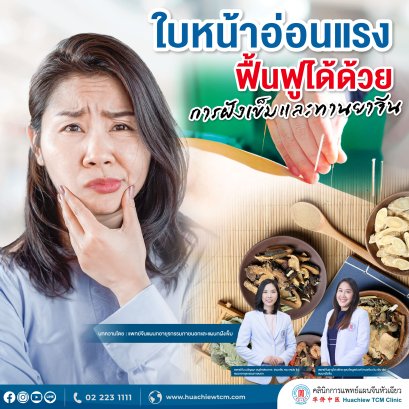 ใบหน้าอ่อนแรง  ฝังเข็มช่วยฟื้นฟู 