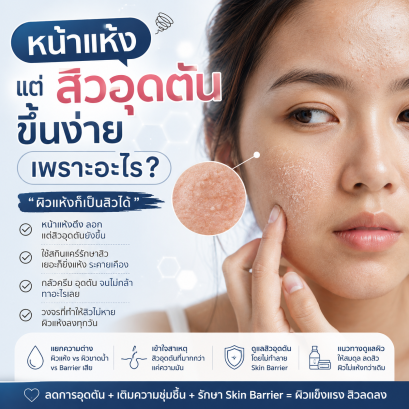 เป็นคนผิวแห้ง แต่สิวอุดตันขึ้นง่ายมาก เพราะอะไร บทความโดยเภสัชกร