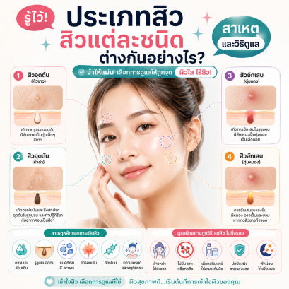 ประเภทสิว สิวมีกี่ประเภท สิวอุดตัน สิวอักเสบ สิวผด  บทความโดยเภสัชกร