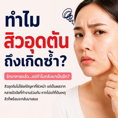 ทำไมสิวอุดตันถึงเกิดซ้ำ? รู้สาเหตุที่แท้จริง แล้วแก้ให้ตรงจุด