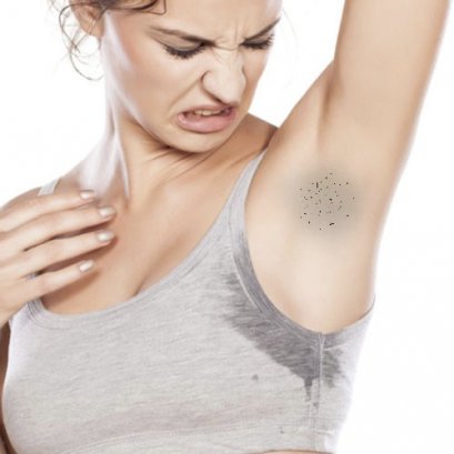 รักแร้ดำ ทำไงดี  ตุ่มหนังไก่ ขนคุด กลิ่นตัว บทความโดยเภสัชกร