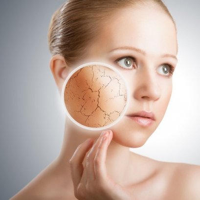 ผิวขาดน้ำ ผิวมันขาดน้ำ คืออะไร เกิดจากอะไร แก้ไขอย่างไรดี