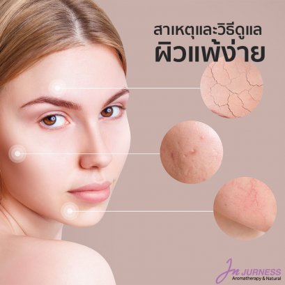 สาเหตุและวิธีดูแลผิวแพ้ง่าย