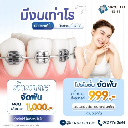 คอร์ส จัดฟัน