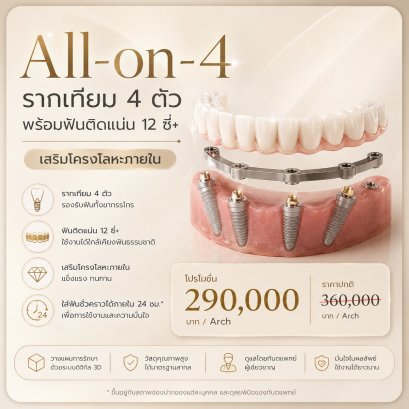 All-on-4 รากฟันเทียมทั้งปาก ฟันติดแน่น 12 ซี่