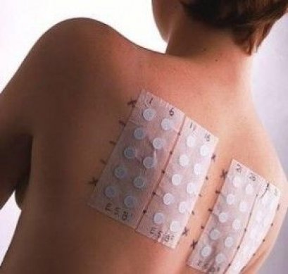 อยากทำ Patch Test ต้องเตรียมตัวอย่างไรบ้าง