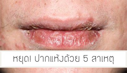 สาเหตุทีทำให้ริมฝีปากแห้ง แบบที่ไม่เคยคาดคิดมาก่อน