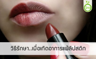 วิธีรักษา..เมื่อเกิดอาการแพ้ลิปสติก