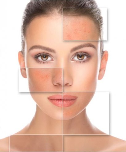 เช็คด่วน สัญญาณเตือนเมื่อผิวเเพ้ง่าย