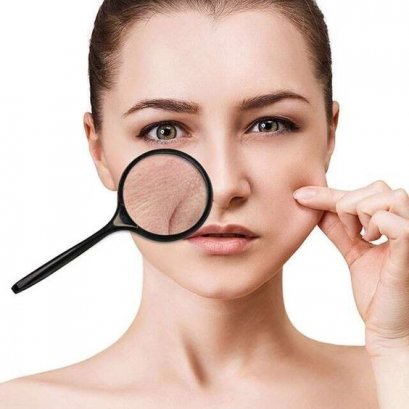 6 วิธีบอกลาปัญหาผิวแห้ง...ให้กลับมาชุ่มชื้นอีกครั้ง 