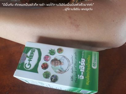 สมุนไพรรักษามะเร็งต่อมน้ำเหลือง