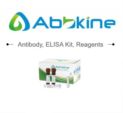 IDH3B Polyclonal Antibody,100&mu;l