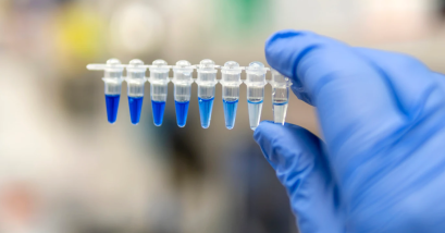 PCR และ qPCR: หลักการพื้นฐานและการประยุกต์ใช้ในงานด้านชีววิทยาและการแพทย์