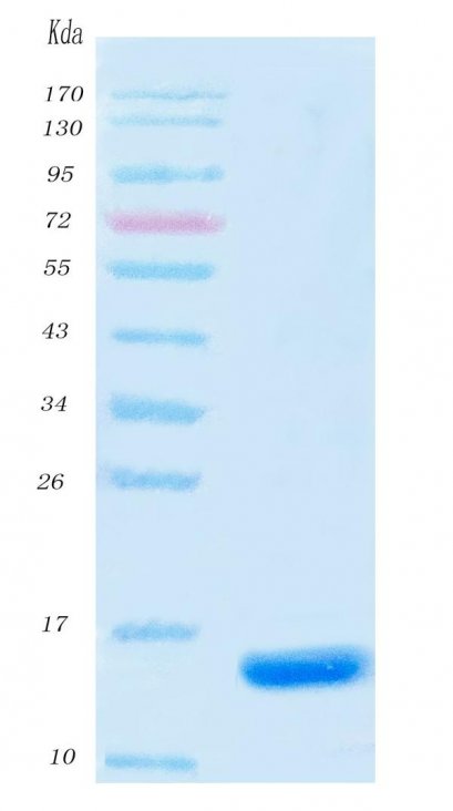 SARS-CoV-2 (COVID-19) NSP9 Protein, His Tag, 100μg/vial