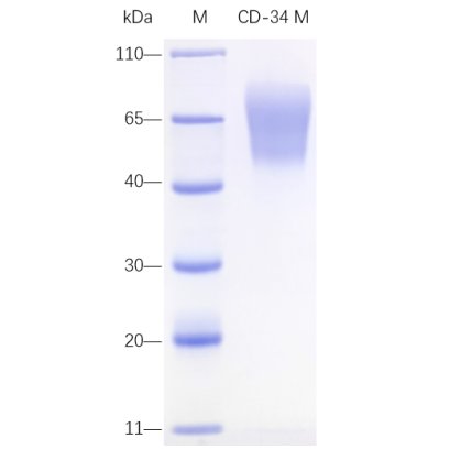 Recombinant Mouse CD34 Protein (His-tag)