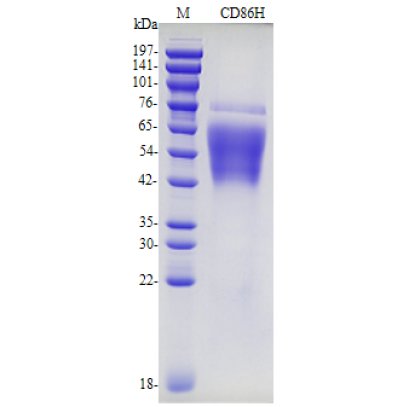 Recombinant Human CD86 Protein (His-tag)